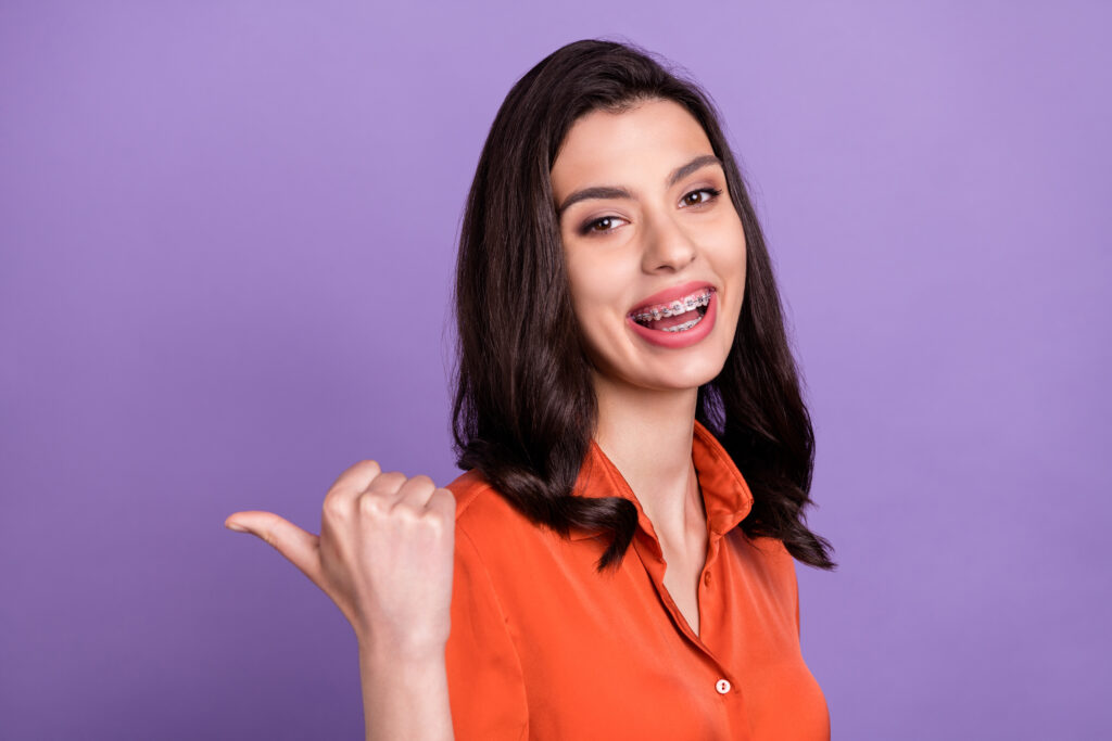 Is Purple A Good Color For Braces? - The Braces Guide